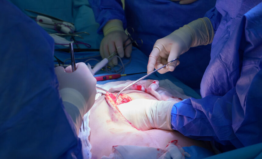 2023.10.05. - Spanci_op_-2378